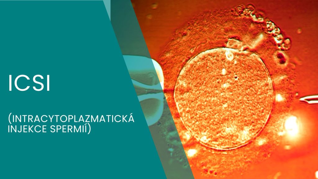 ICSI - intracytoplazmatická injekce spermií